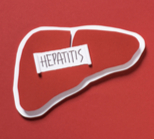 האם ייתכן שיש לך הפטיטיס?-תמונה